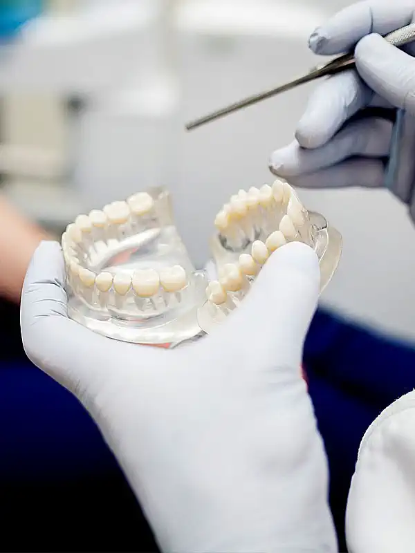 Zirconium Crowns (Hollywood Smile) Zirconium Crowns (Hollywood Smile)